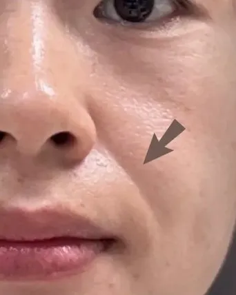 攝取前肌膚